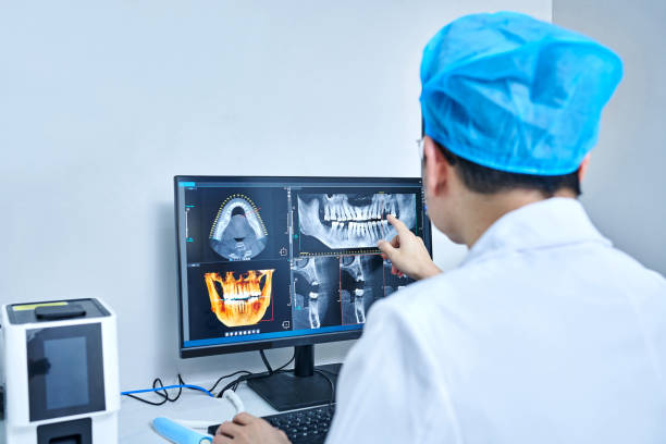 Best Emergency Treatment for Dental Infections or Abscesses in Lenwood, CA