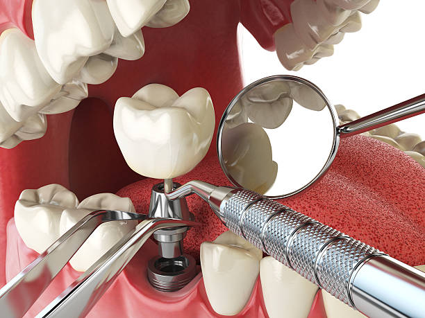 Best 24-Hour Emergency Dentist in Lenwood, CA